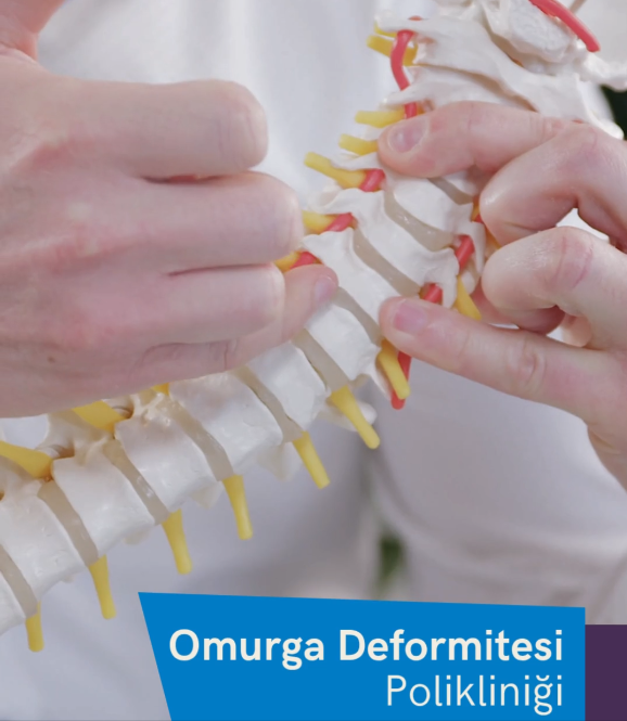Omurga Deformitesi Polikliniği